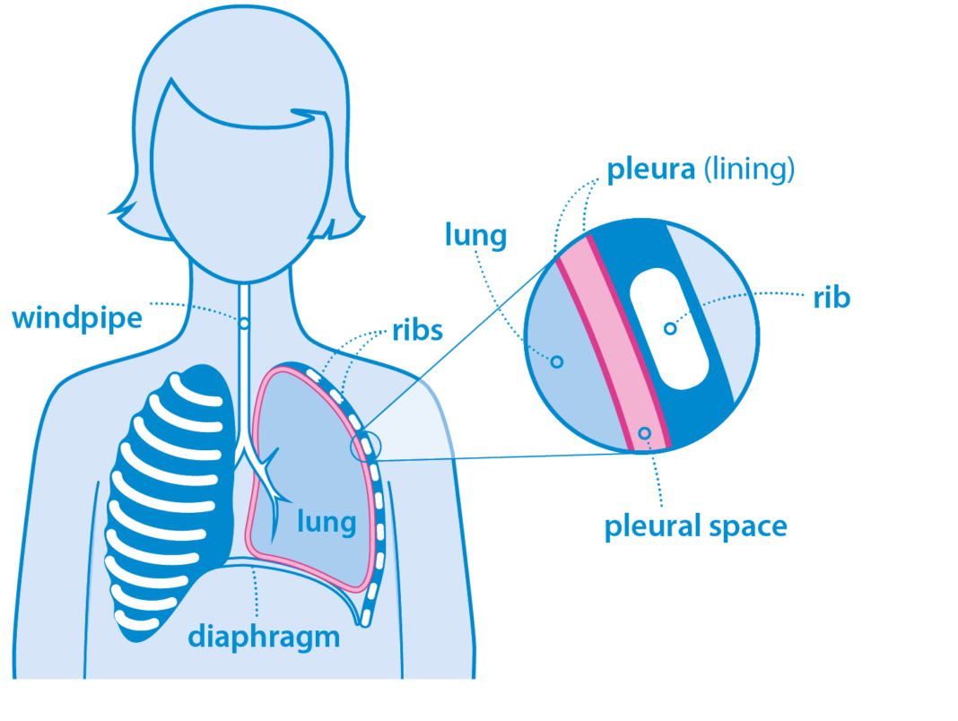 Cancer Symptoms and Treatments